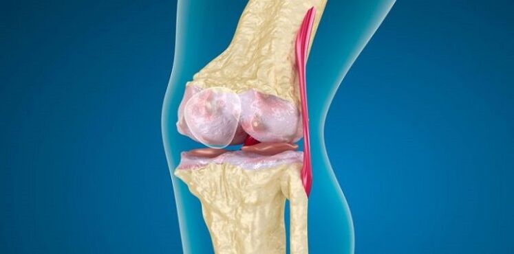Schued beim Knie Gelenk fir Arthrosis