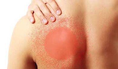 Péng ënnert der lénkser Schëllerblad