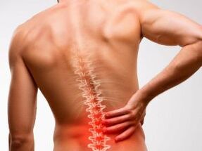 Schmerz am ënneschte Réck wéinst Osteochondrose